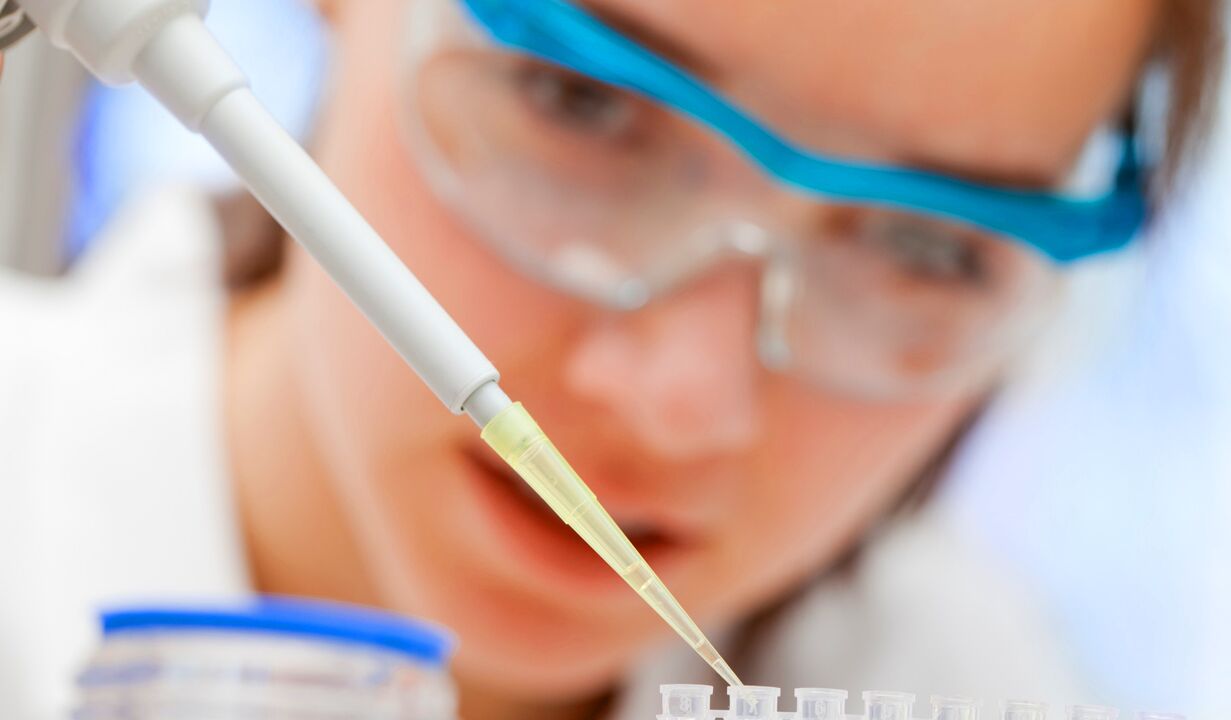 Analisi di laboratorio delle urine - un metodo per diagnosticare la prostatite