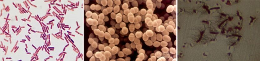 E. coli, enterococco fecale e proteus sono i principali agenti eziologici della prostatite batterica cronica